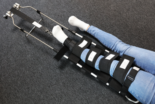 3715 Hare traction splint på ben_2